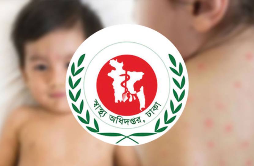 হাম উপসর্গে ৩ জনের মৃত্যু, আক্রান্ত ১০৬৪