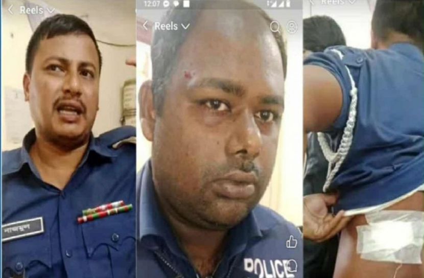 তদন্ত করতে  গিয়ে সন্ত্রাসী হামলায় আহত ৩ পুলিশ