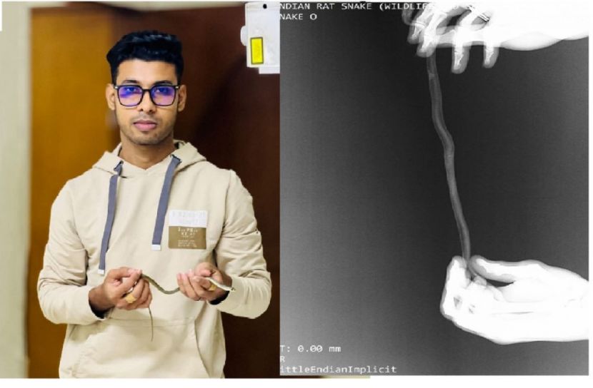 ফেনীতে প্রথমবারের মতো আহত নির্বিষ দাঁড়াশ সাপের এক্সরে