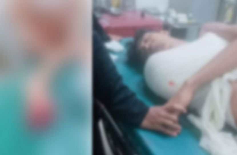 ট্রাকের ধাক্কায় তরুণের হাত বিচ্ছিন্ন