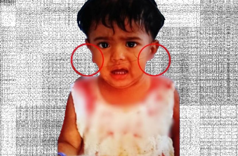 ছিনতাইয়ের কবলে আহত শিশু