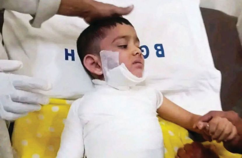 চন্দনাইশে গরম পানির ডেকচিতে পড়ে শিশুর মৃত্যু