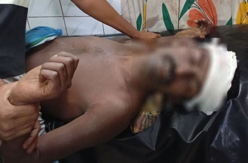 বোয়ালখালীতে ট্রেনের ধাক্কায় যুবক গুরুতর আহত