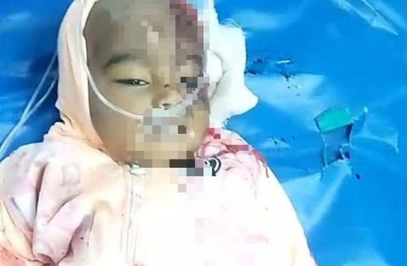 পেকুয়ায় মুখোমুখি সংঘর্ষে দুই বছরের শিশুর মৃত্যু, ৫ জন আহত