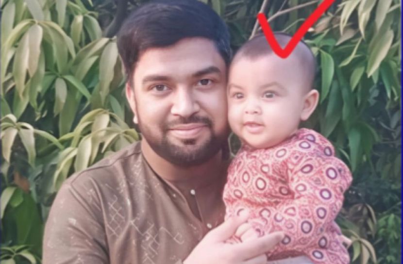 ফটিকছড়িতে গরম পানিতে পড়ে এক শিশুর মৃত্যু