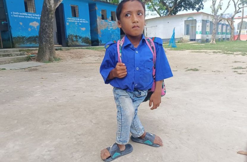 জন্মগত প্রতিবন্ধকতাও থামাতে পারেনি পাঁচবিবির শিশু কাফিকে