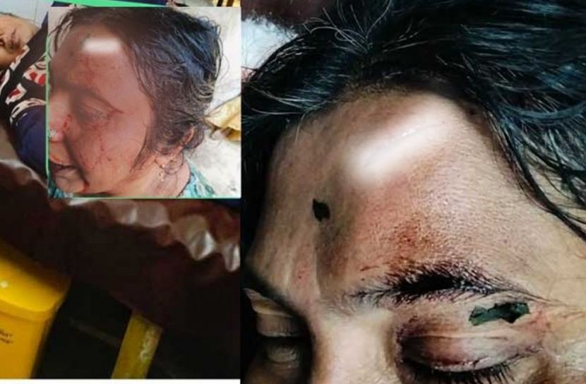 সাতকানিয়ায় নারীকে হত্যাচেষ্টার অভিযোগ, মামলা নেয়নি পুলিশ